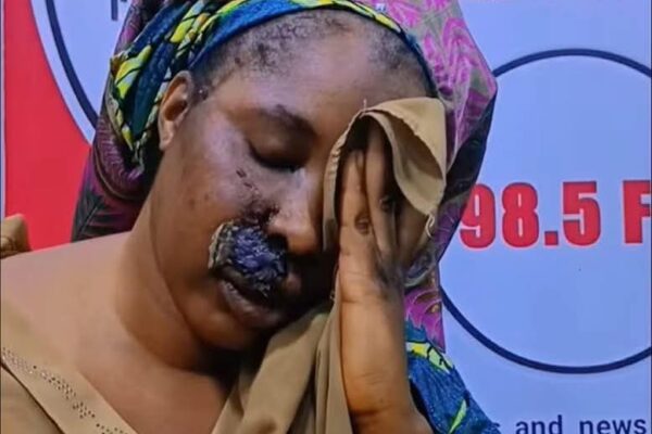 FB IMG 1771433367811